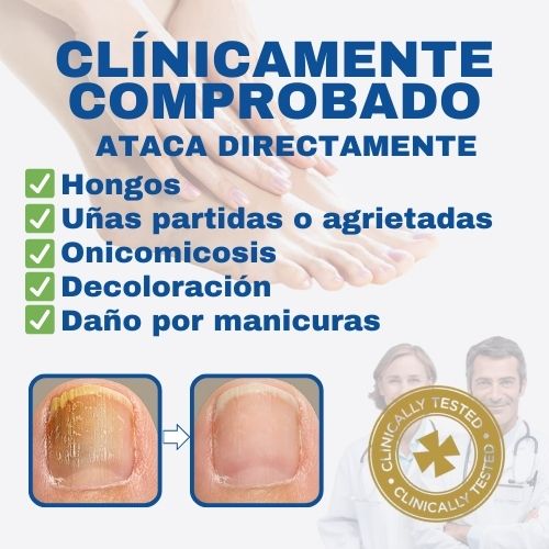 32 Parches anti-hongos para uñas