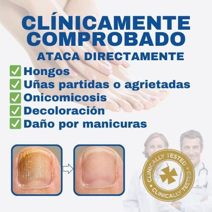 32 Parches anti-hongos para uñas